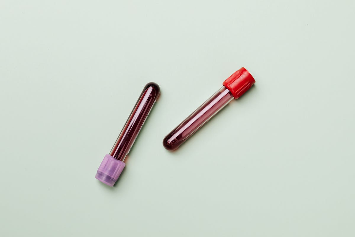 Blood test bloodwork for TRT UK